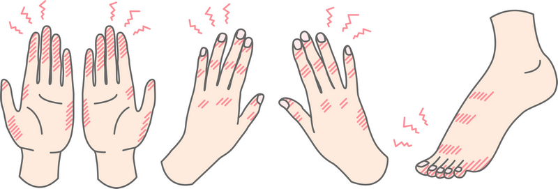 あかぎれ・ひび割れのイメージ